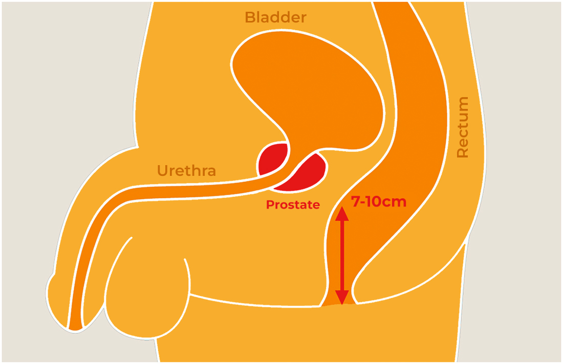 Graphic Prostate View